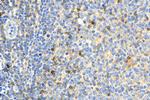 TNFR2 Antibody in Immunohistochemistry (Paraffin) (IHC (P))