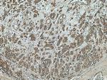 TRIM27 Antibody in Immunohistochemistry (Paraffin) (IHC (P))