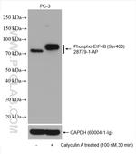 Phospho-eIF4B (Ser406) Antibody in Western Blot (WB)