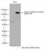 Phospho-MAP3K1 (Thr1400) Antibody in Western Blot (WB)