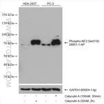 Phospho-NF2 (Ser518) Antibody in Western Blot (WB)