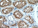 ACE2 Antibody in Immunohistochemistry (Paraffin) (IHC (P))