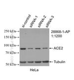 ACE2 Antibody in Western Blot (WB)