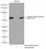 Phospho-GRB10 (Ser476) Antibody in Western Blot (WB)