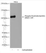 Phospho-PLA2G4A (Ser505) Antibody in Western Blot (WB)