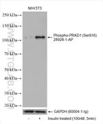 Phospho-PRKD1 (Ser916) Antibody in Western Blot (WB)