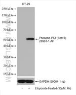 Phospho-P53 (Ser15) Antibody in Western Blot (WB)