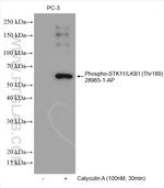 Phospho-STK11 (Thr189) Antibody in Western Blot (WB)