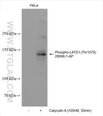 Phospho-LATS1 (Thr1079) Antibody in Western Blot (WB)