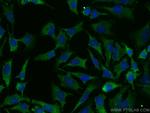 ULK1 Antibody in Immunocytochemistry (ICC/IF)