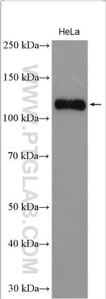 ULK1 Antibody in Western Blot (WB)