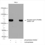 Phospho-ULK1 (Thr468) Antibody in Western Blot (WB)