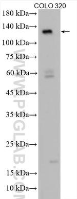 APAF1 Antibody in Western Blot (WB)