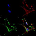 MMP9 Metalloproteinase Antibody in Immunocytochemistry (ICC/IF)