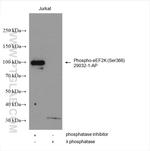 Phospho-eEF2K (Ser366) Antibody in Western Blot (WB)