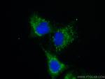 MMP14 Antibody in Immunocytochemistry (ICC/IF)