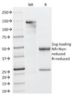 Galectin-13 (GAL13)/Placental Protein 13 (PP13) Antibody in SDS-PAGE (SDS-PAGE)