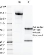 Galectin-13 (GAL13)/Placental Protein 13 (PP13) Antibody in SDS-PAGE (SDS-PAGE)