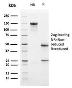 PD-L1/PDCD1LG1/CD274/B7-H1 (Cancer Immunotherapy Target) Antibody in SDS-PAGE (SDS-PAGE)