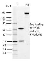 PD-L1/PDCD1LG1/CD274/B7-H1 (Cancer Immunotherapy Target) Antibody in SDS-PAGE (SDS-PAGE)