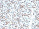 PD-L1/PDCD1LG1/CD274/B7-H1 (Cancer Immunotherapy Target) Antibody in Immunohistochemistry (Paraffin) (IHC (P))