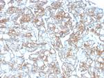 PD-L1/PDCD1LG1/CD274/B7-H1 (Cancer Immunotherapy Target) Antibody in Immunohistochemistry (Paraffin) (IHC (P))