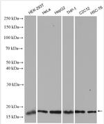 H3K36me2 Antibody in Western Blot (WB)