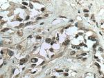 IFI16 Antibody in Immunohistochemistry (Paraffin) (IHC (P))