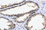 PCNP Antibody in Immunohistochemistry (Paraffin) (IHC (P))