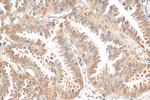 STK11/LKB1 Antibody in Immunohistochemistry (Paraffin) (IHC (P))