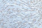 AQP2 Antibody in Immunohistochemistry (Paraffin) (IHC (P))