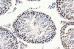 RAD50 Antibody in Immunohistochemistry (Paraffin) (IHC (P))