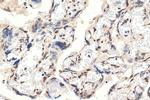 RAD50 Antibody in Immunohistochemistry (Paraffin) (IHC (P))