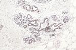 RAD50 Antibody in Immunohistochemistry (Paraffin) (IHC (P))