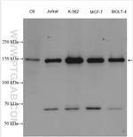 RAD50 Antibody in Western Blot (WB)