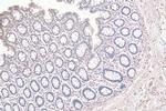 LEMD2 Antibody in Immunohistochemistry (Paraffin) (IHC (P))