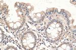 LEMD2 Antibody in Immunohistochemistry (Paraffin) (IHC (P))