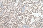 FUT8 Antibody in Immunohistochemistry (Paraffin) (IHC (P))