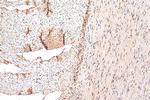 YTHDC1 Antibody in Immunohistochemistry (Paraffin) (IHC (P))