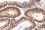 YTHDC1 Antibody in Immunohistochemistry (Paraffin) (IHC (P))