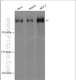 BRCA2 Antibody in Western Blot (WB)