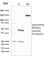 Glutathione S-Transferase Mu2 (GSTM2) Antibody in SDS-PAGE (SDS-PAGE)