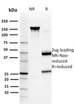 Glutathione S-Transferase Mu3 (GSTM3) Antibody in SDS-PAGE (SDS-PAGE)