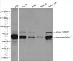 PKMYT1 Antibody in Western Blot (WB)