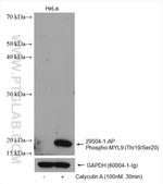 Phospho-MYL9 (Thr19, Ser20) Antibody in Western Blot (WB)