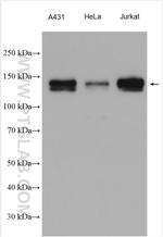 PHF8 Antibody in Western Blot (WB)