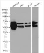 GLS Antibody in Western Blot (WB)