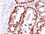 MSH6 (DNA Mismatch Repair Protein) Antibody in Immunohistochemistry (Paraffin) (IHC (P))