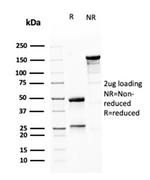 MSH6 (DNA Mismatch Repair Protein) Antibody in SDS-PAGE (SDS-PAGE)