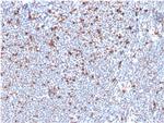 MSH6 (DNA Mismatch Repair Protein) Antibody in Immunohistochemistry (Paraffin) (IHC (P))